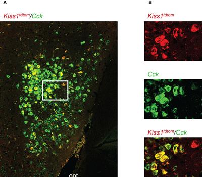 The molecular phenotype of kisspeptin neurons in the medial amygdala of female mice